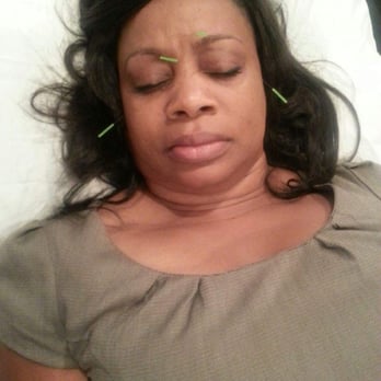 Craig Swogger, L.Ac - Feels great and relaxing - Acupuncture Near Me - Culver City, California Craig Swogger, L.Ac - Feels great and relaxing - Acupuncture Near Me - Culver City, California