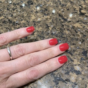 5 Elements Skin and Nails Spa - After two and a half weeks...amazing! Thank you Hannah - Skin Care Near Me - Methuen, Massachusetts 5 Elements Skin and Nails Spa - After two and a half weeks...amazing! Thank you Hannah - Skin Care Near Me - Methuen, Massachusetts