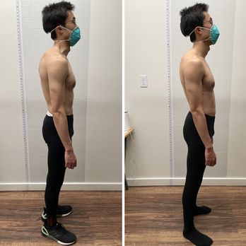 Bodywork by Ari - Before and After - Massage Therapy Near Me - Walnut Creek, California Bodywork by Ari - Before and After - Massage Therapy Near Me - Walnut Creek, California