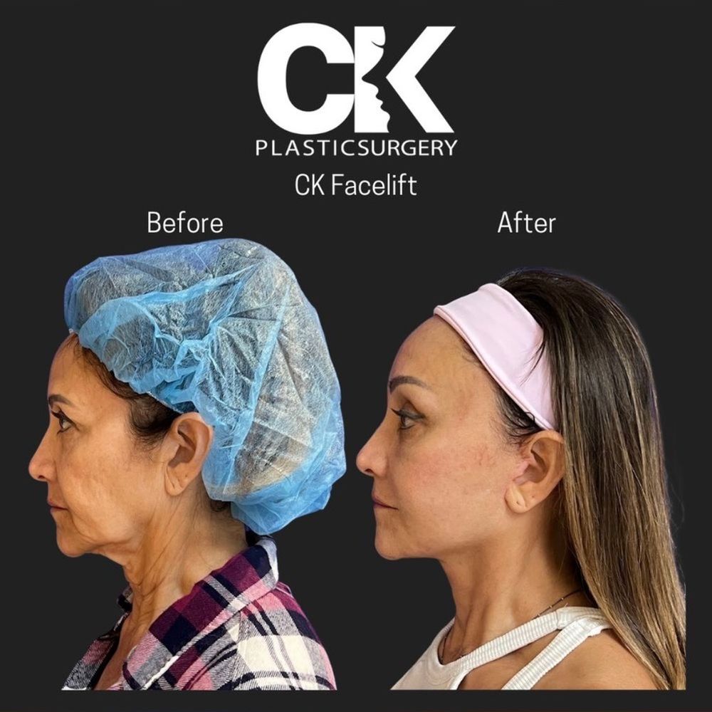 CK Plastic Surgery - Cosmetic Surgeons Near Me - Los Angeles, California CK Plastic Surgery - Cosmetic Surgeons Near Me - Los Angeles, California