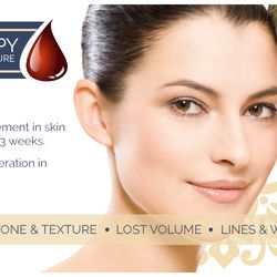 Beauty Medical Clinic - Holiday season prep: $200 off Vampire face lift ( $700 regular price)