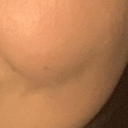My skin results from La Bella Skin My skin results from La Bella Skin