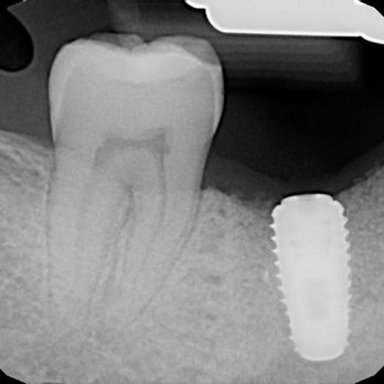 MGK’s Dental Temple - General Dentistry Near Me - Allentown, Pennsylvania MGK’s Dental Temple - General Dentistry Near Me - Allentown, Pennsylvania