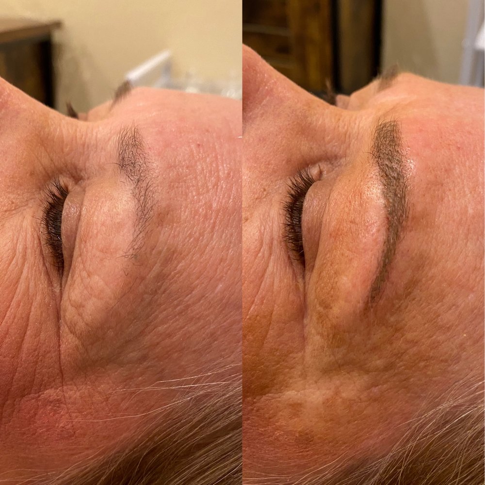 Skin Rejuvenation Logo