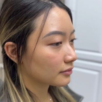 Skin Perfect Brothers - Before - Laser Hair Removal Near Me - Walnut, California Skin Perfect Brothers - Before - Laser Hair Removal Near Me - Walnut, California