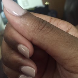 Chipped gel nails after 3 days. Chipped gel nails after 3 days.