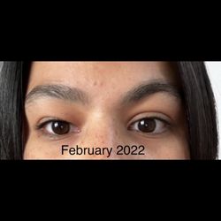 Oculoplastic & Orbital Consultants: Dr. Michael A. Connor - 2022: before any surgeries