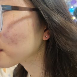 Ray Pierced her ear!