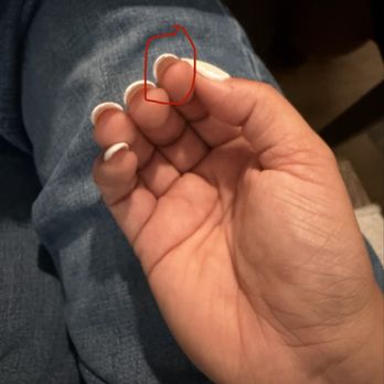 Citrus Nail Bar Lucas - The glue is excessive and made my nail underneath thick - Nail Salons Near Me - Lucas, Texas Citrus Nail Bar Lucas - The glue is excessive and made my nail underneath thick - Nail Salons Near Me - Lucas, Texas
