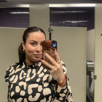 Iconic Skin Clinic- Downey - SkinVive done in February 2024 (Photo taken April 2024) - Medical Spas Near Me - Downey, California Iconic Skin Clinic- Downey - SkinVive done in February 2024 (Photo taken April 2024) - Medical Spas Near Me - Downey, California