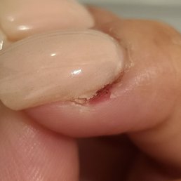 Cut by male technician