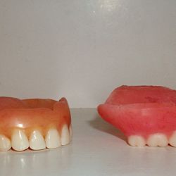 Secure Dentures and Implants - Side profile of dentures