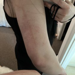 My arm