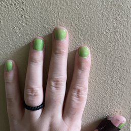Finger color/somewhat inconsistent (bandaid on cut)