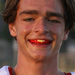 We fabricate custom athletic mouthguards