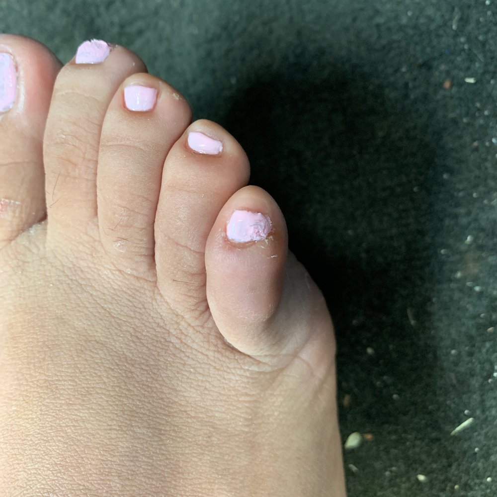 Platinum Nails - Pedicure horribly done - Nail Salons Near Me - Orlando, Florida