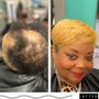 Photo of PHD Hair Solutions 