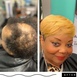 PHD Hair Solutions  - Cranial Prosthesis and non-surgical hair replacement  solutions for women experiencing hair loss. Serving East Cobb and Alpharetta