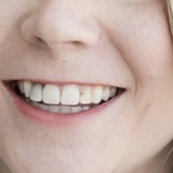 Landmark Dental