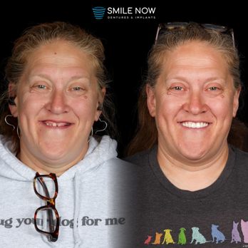 Smile Now Eugene Dentures and Implants - General Dentistry Near Me - Eugene, Oregon Smile Now Eugene Dentures and Implants - General Dentistry Near Me - Eugene, Oregon