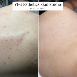 YEG Esthetics Skin Studio