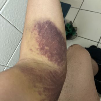 LABCORP - Updated February 2026 - 12 Photos & 33 Reviews - 950 E ...