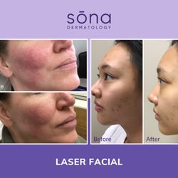 Sona Dermatology of Greensboro