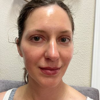 Cannery Row Medical Aesthetics - Skin Care Near Me - Monterey, California Cannery Row Medical Aesthetics - Skin Care Near Me - Monterey, California