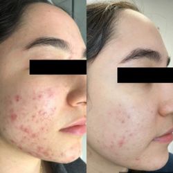 Suit Yourself Skin Care