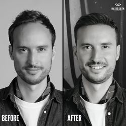 Hair by Bryan Dean - One of the Many HairSkeen Options that I offer. This is just for those struggling with minimal hair loss in the front