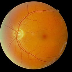 Cary Family Eye Care - Advanced diagnostic imaging