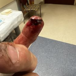 Optim Orthopedics