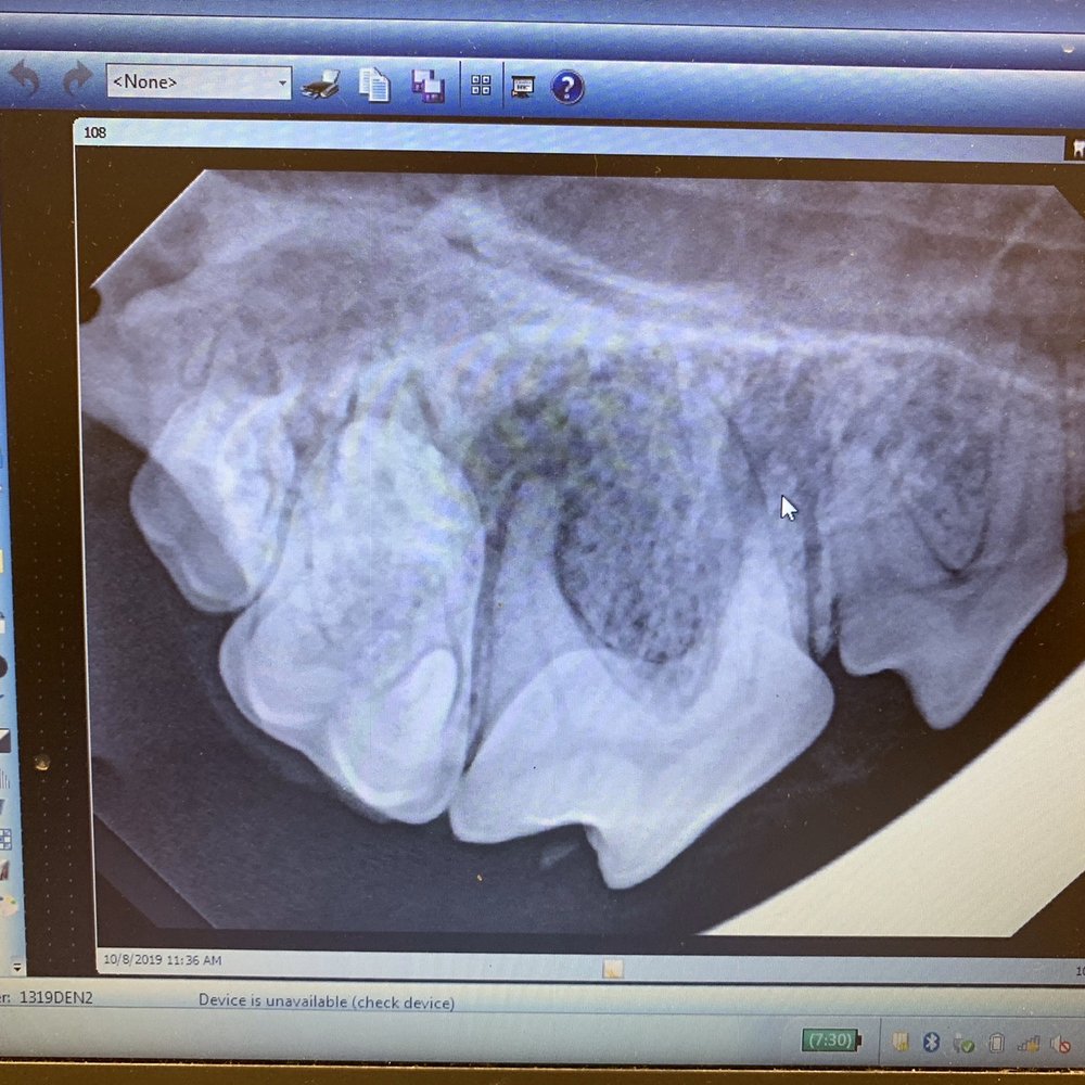 Chloe's tooth with "halo" over the root. Chloe's tooth with "halo" over the root.