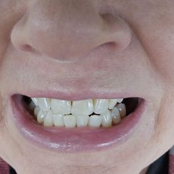 Superior Dental Health