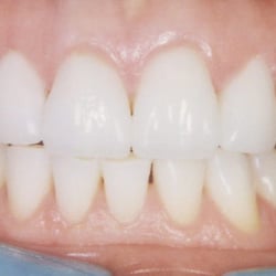 Eric Meyer, DDS - Fullerton Dental