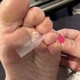 The small toe where the cut was. It's still there but the scab just fell off yesterday. The small toe where the cut was. It's still there but the scab just fell off yesterday.