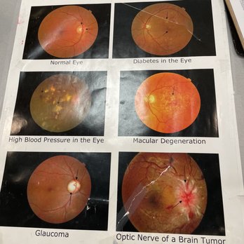 MyEyeDr - Paid $39 no result!! - Optometrists Near Me - Kissimmee, Florida MyEyeDr - Paid $39 no result!! - Optometrists Near Me - Kissimmee, Florida