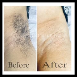 Perfect Beauty Bar - Underarms waxing $14
Done at perfect beauty bar !!