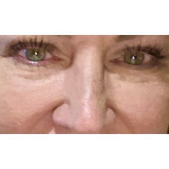 Coco Med Spa - Before with makeup - Medical Spas Near Me - St. Petersburg, Florida Coco Med Spa - Before with makeup - Medical Spas Near Me - St. Petersburg, Florida