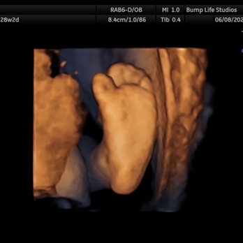 Bump Life 4D Ultrasound Studio - Ultrasound Imaging Centers Near Me - Madison, Alabama Bump Life 4D Ultrasound Studio - Ultrasound Imaging Centers Near Me - Madison, Alabama