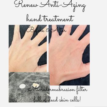 Lavande Face & Body - Microdermabrasion treatment on hands.
Great treatment to remove all the dead skin that can age your hands!
#antiaging#selfcare - Skin Care Near Me - Plano, Texas Lavande Face & Body - Microdermabrasion treatment on hands.
Great treatment to remove all the dead skin that can age your hands!
#antiaging#selfcare - Skin Care Near Me - Plano, Texas