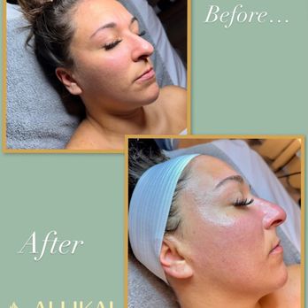 Allikai Spa - Advance Deep Clean Facial - Massage Near Me - Monroe, Connecticut Allikai Spa - Advance Deep Clean Facial - Massage Near Me - Monroe, Connecticut