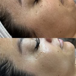 Lueur Skin - Hydrafacial Glow