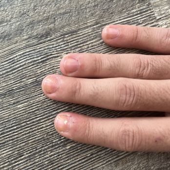 American Spa Nails - Yellow stains on finger nails - Nail Salons Near Me - Sanford, Florida American Spa Nails - Yellow stains on finger nails - Nail Salons Near Me - Sanford, Florida