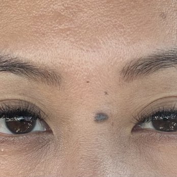 Skin Perfect Brothers - Laser Hair Removal Near Me - Walnut, California Skin Perfect Brothers - Laser Hair Removal Near Me - Walnut, California