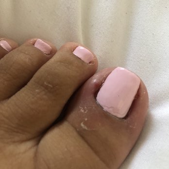 Sunny's Nails Spa - My toes has been throbbing non stop since I left! You can even see the clear coat not properly put on. - Nail Salons Near Me - Palmdale, California