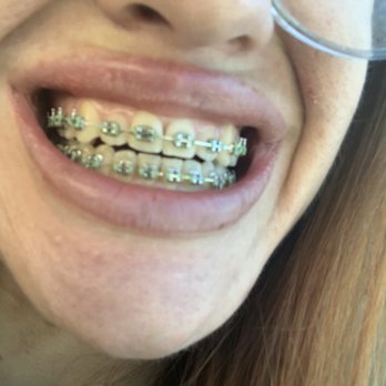 May Dental - Cosmetic Dentists Near Me - Valencia, California May Dental - Cosmetic Dentists Near Me - Valencia, California