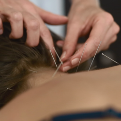 Laura A Powers, LAc, DiplAc - Recommended by the American College of Physicians