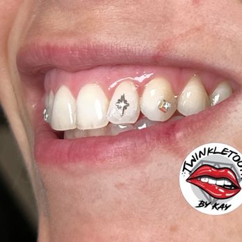 Twinkletooth By Kay - "Sometimes the brightest star is the one that guides you home" - Teeth Whitening Near Me Twinkletooth By Kay - "Sometimes the brightest star is the one that guides you home" - Teeth Whitening Near Me