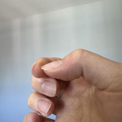 Softy Nails - Right hand after removal